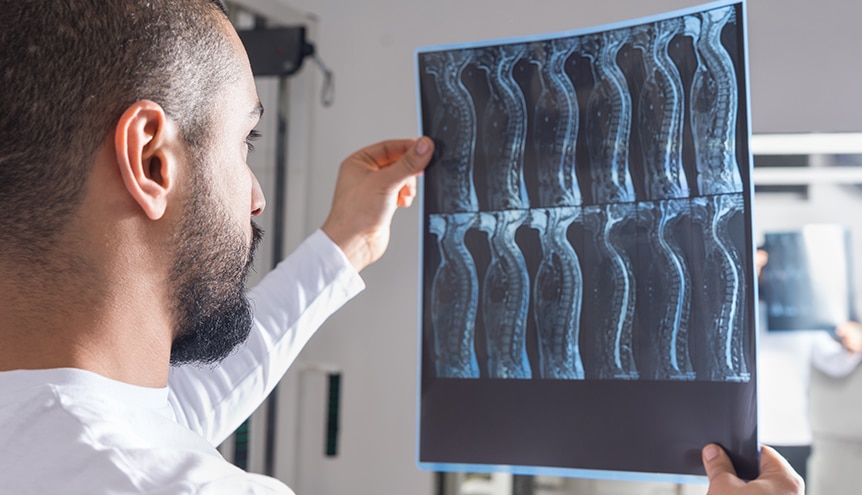 Spinal Cord Spinal Cord Injury Xray