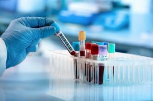 New Blood Test Should Help ER Doctors Assess TBIs Sooner